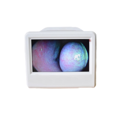 Medizinischer elektronisches Bild-Prüfer HNO-HD tragbare Endoscope-Kamera